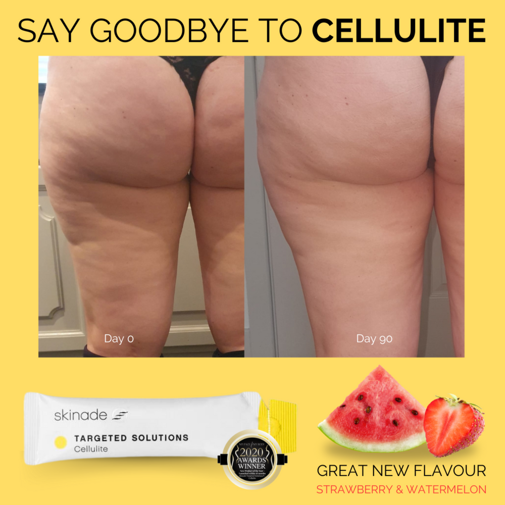 Skinade Targeted Solutions Cellulite 90 Day Supply