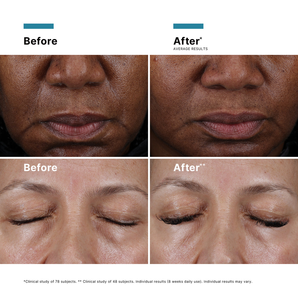 {{Product vendor}} {{Product title}} Exfoliator, Moisturiser