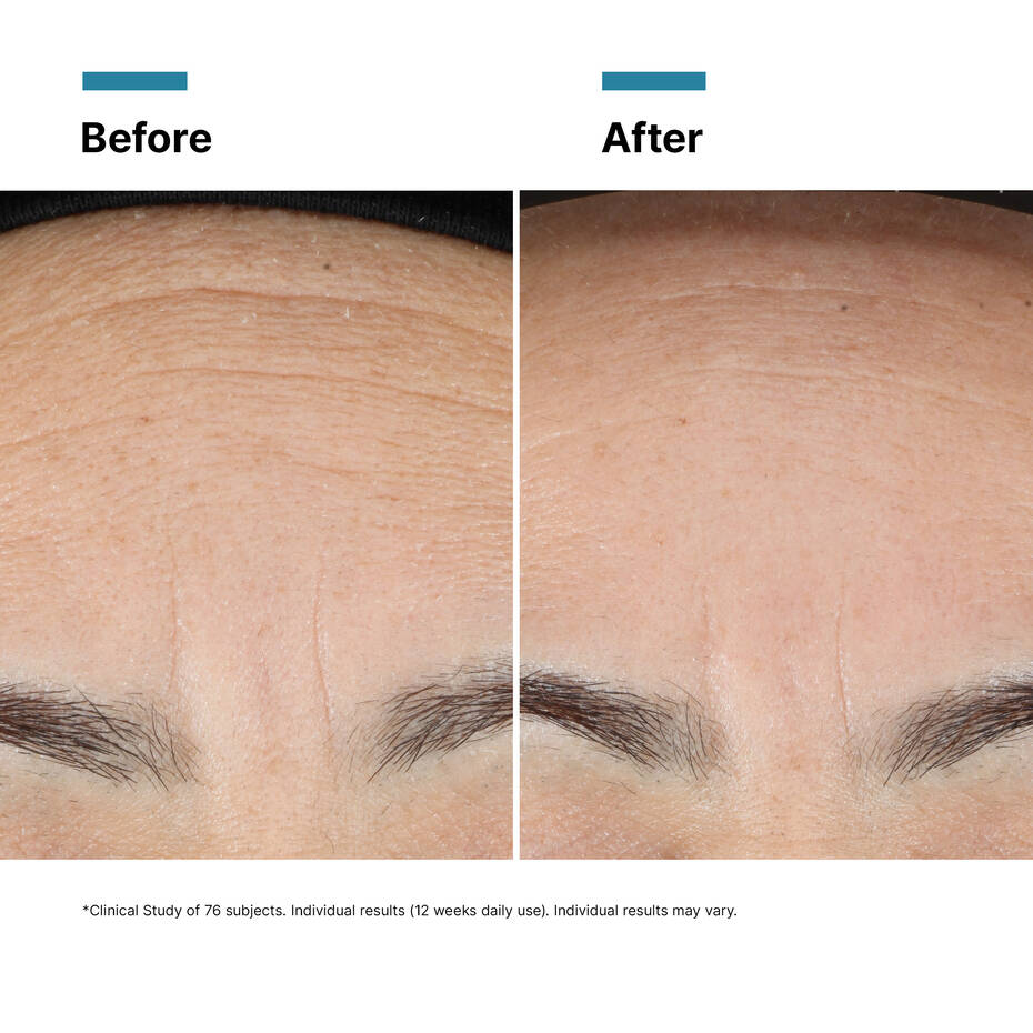 SkinCeuticals Skin Renewal Bundle