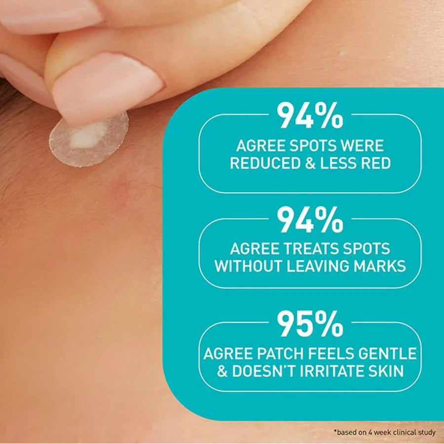 CeraVe Blemish Barrier Patches - 22