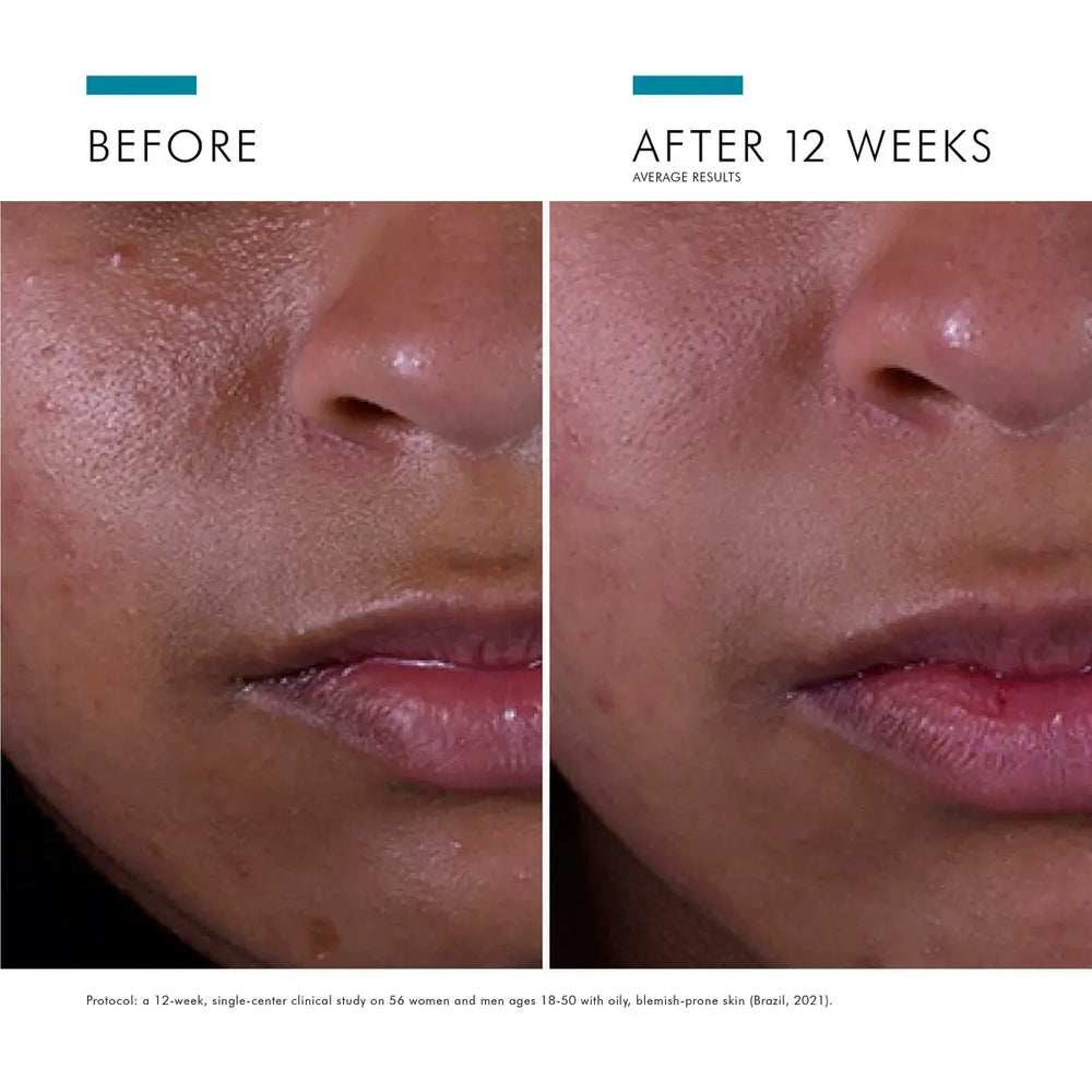 SkinCeuticals Silymarin CF 30ml SkinCeuticals