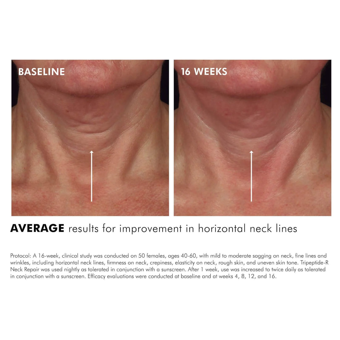 SkinCeuticals Tripeptide-R Neck Repair 50ml SkinCeuticals
