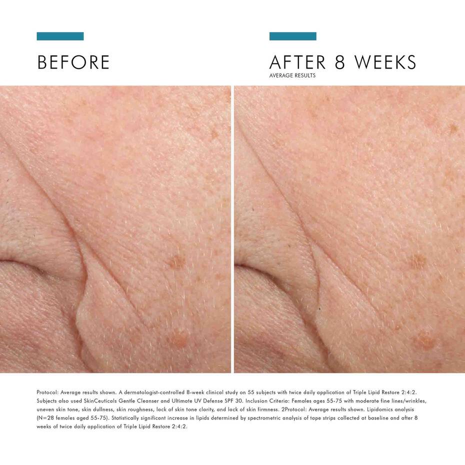 SkinCeuticals Triple Lipid Restore 2:4:2 Moisturiser 48ml SkinCeuticals