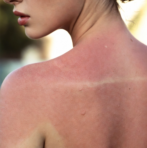 AFTERSUN