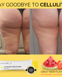 Skinade Targeted Solutions Cellulite 90 Day Supply