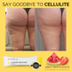 Skinade Targeted Solutions Cellulite