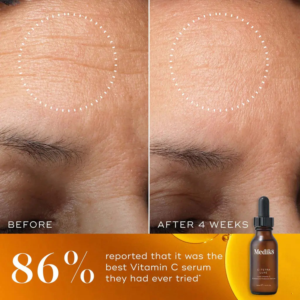 Before and after comparison with Medik8 C-Tetra Luxe serum bottle shown.