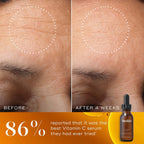 Before and after comparison with Medik8 C-Tetra Luxe serum bottle shown.