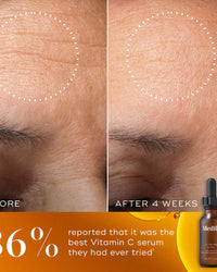 Before and after comparison with Medik8 C-Tetra Luxe serum bottle shown.