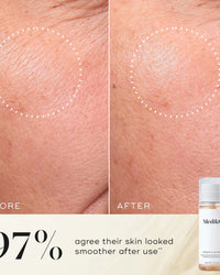 Medik8 press and glow, infographic, close up of skin, results on skin, 97% agree their skin looked smoother after use, before and after, product results
