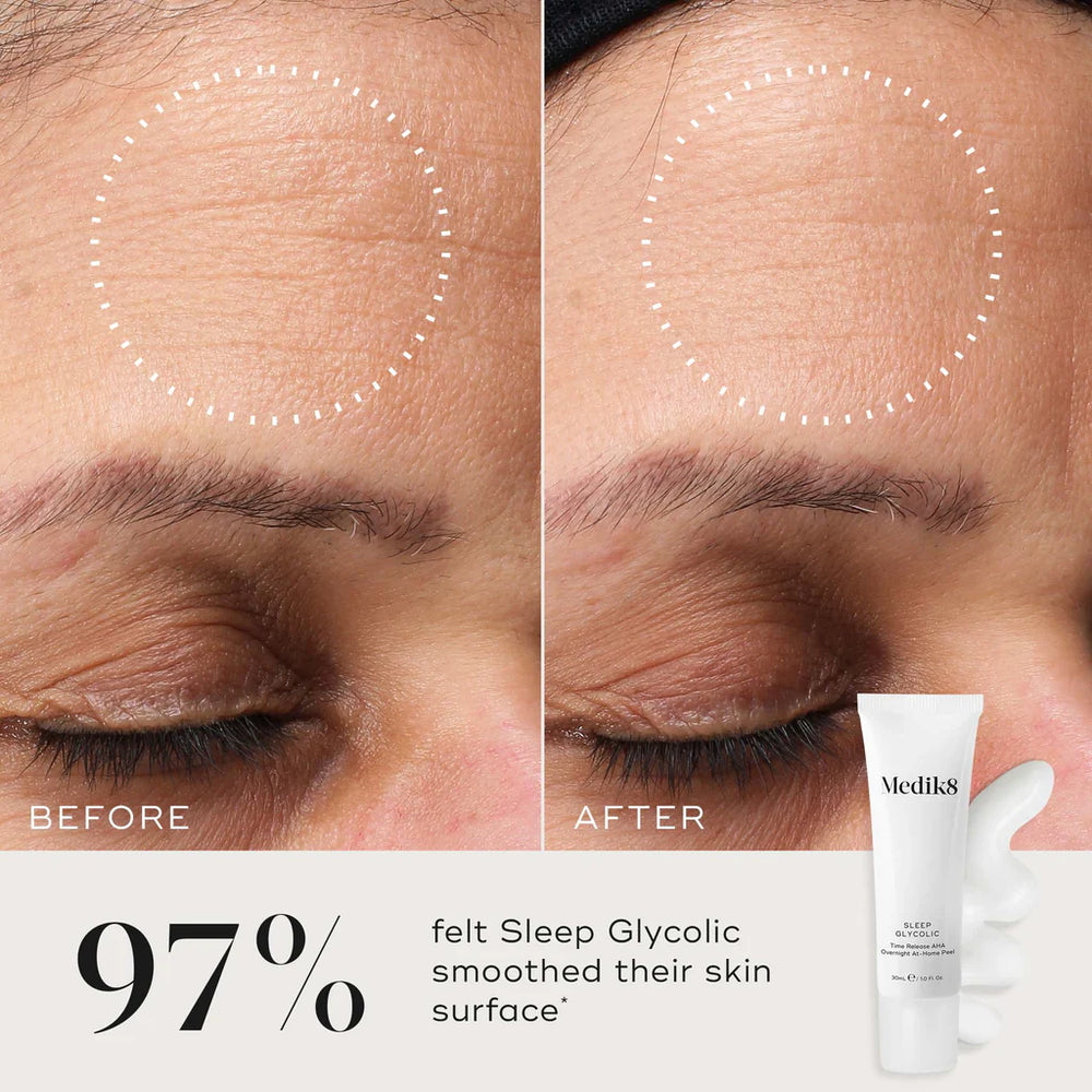 medik8 sleep glycolic infographic, showing close-up pf skin with wrinkles, 97% experienced smoother skin