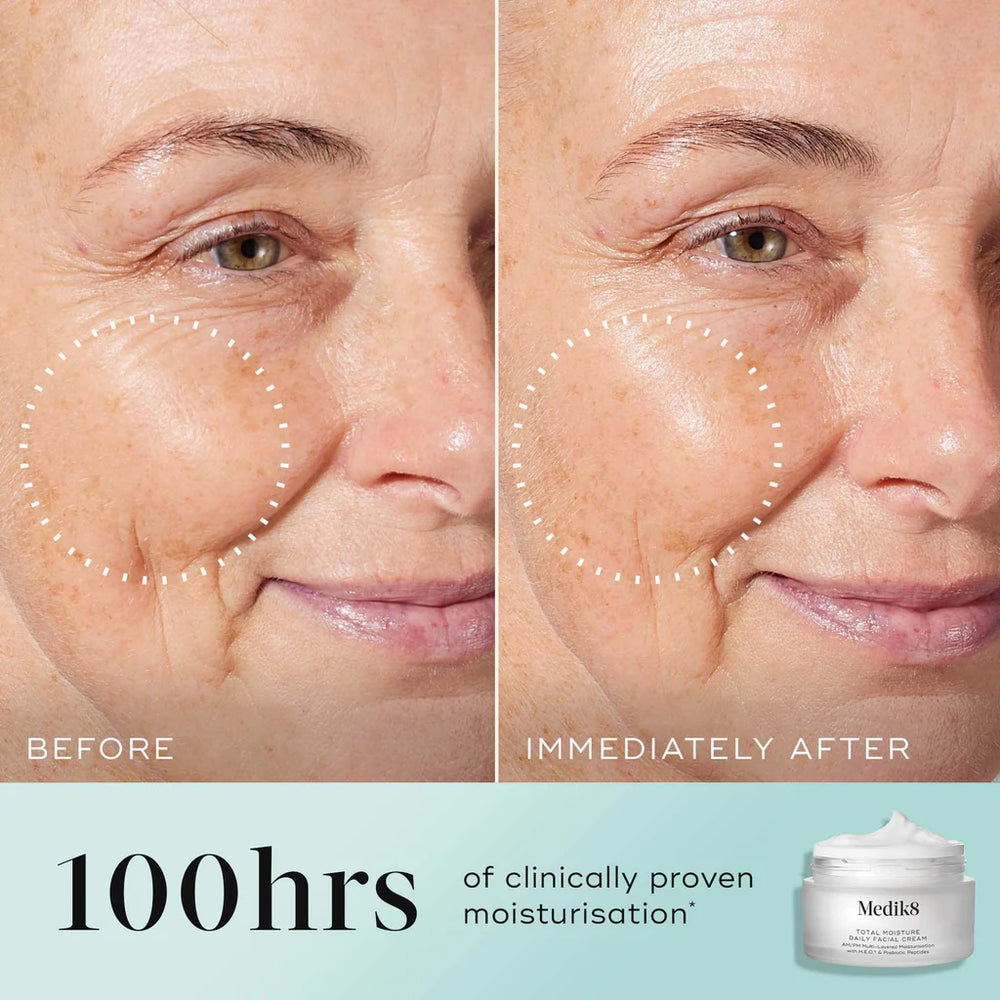 Before and after comparison of a woman's face with visible aging signs, showing the effects of moisturizer application.
