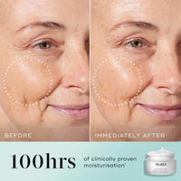 Before and after comparison of a woman's face with visible aging signs, showing the effects of moisturizer application.