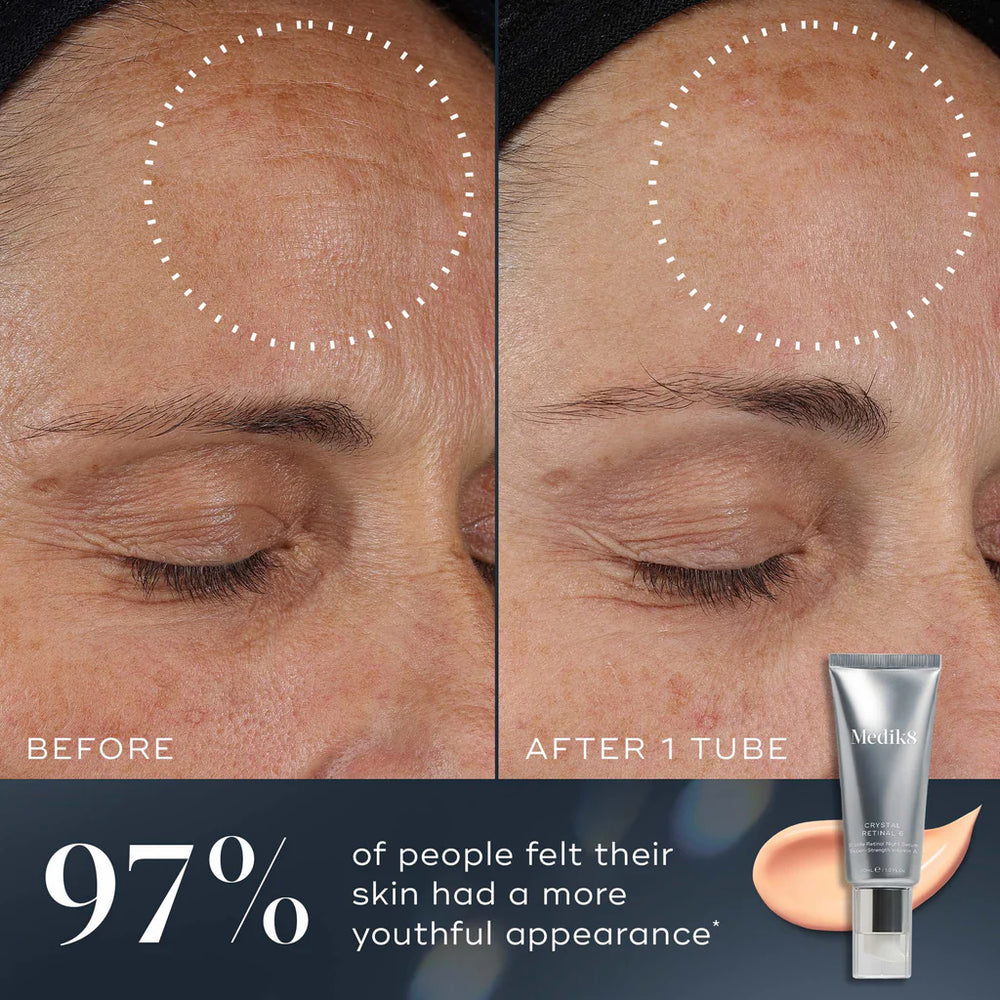 Before and after comparison of skin treatment with a tube Crystal Retinol 24 on a dark background.
