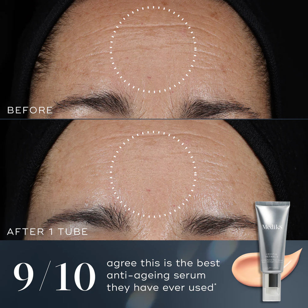 Before and after comparison of a person's forehead with visible lines, featuring a Retinol 24 tube.