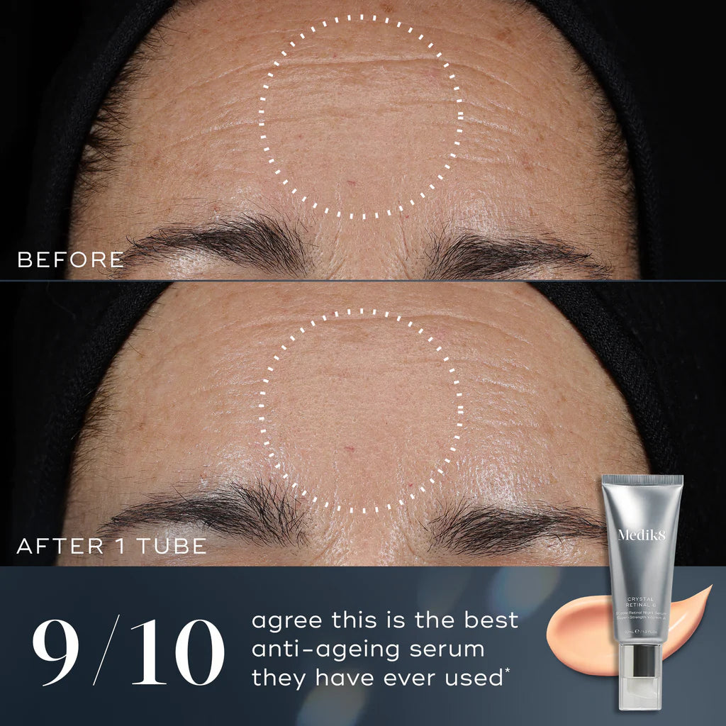 {{Product vendor}} {{Product title}}  Retinol