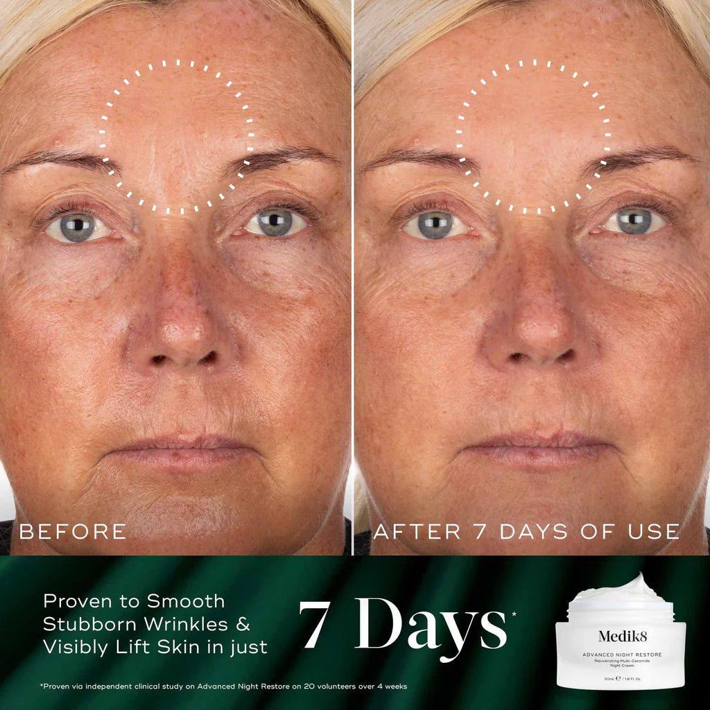 Before and after effect of a skincare product on a woman's face, with '7 Days' branding.