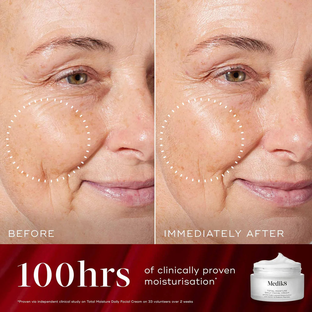 Before and after comparison of a woman's face with visible aging signs, showing the effects of moisturization over 100 hours.