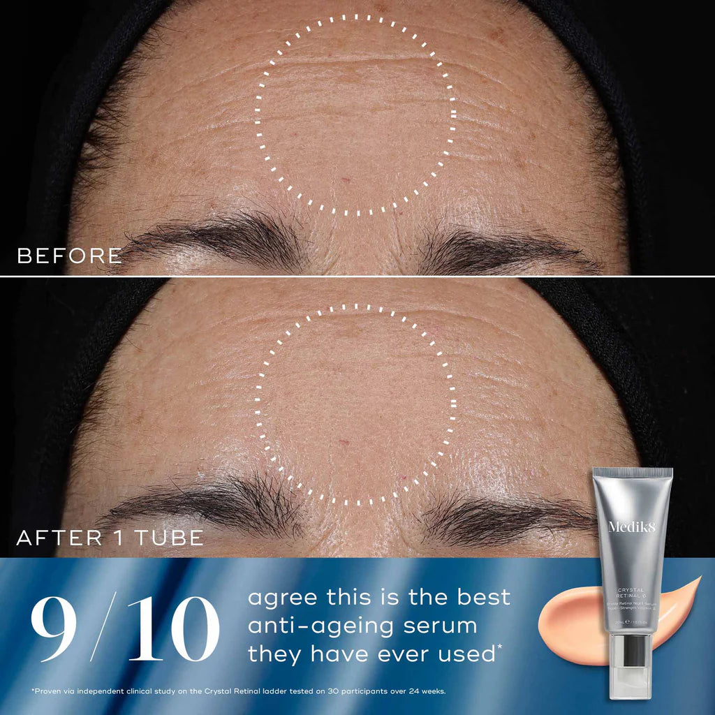 Before and after comparison of a face with wrinkles, featuring a skincare product tube.