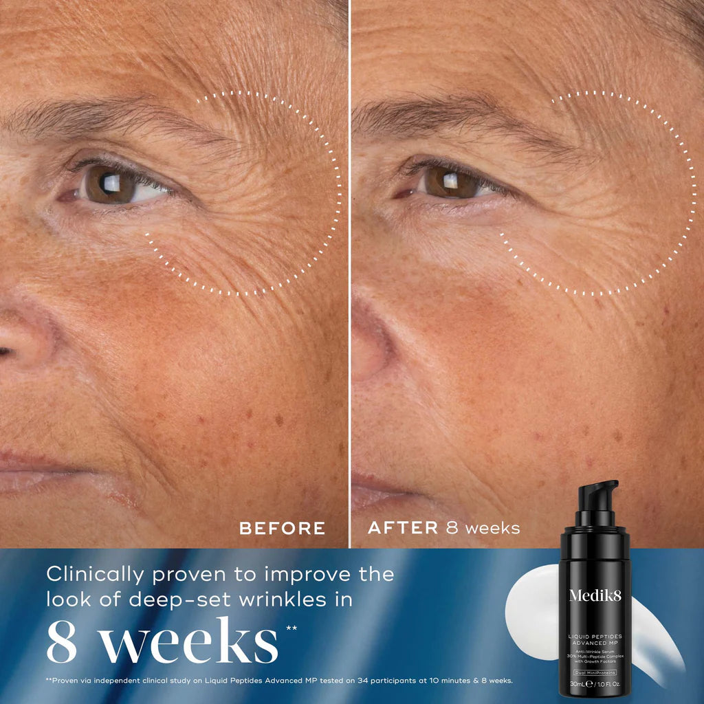 Before and after comparison of a person's face with deep-set wrinkles, showing improvement after 8 weeks, with Medik8 product displayed.
