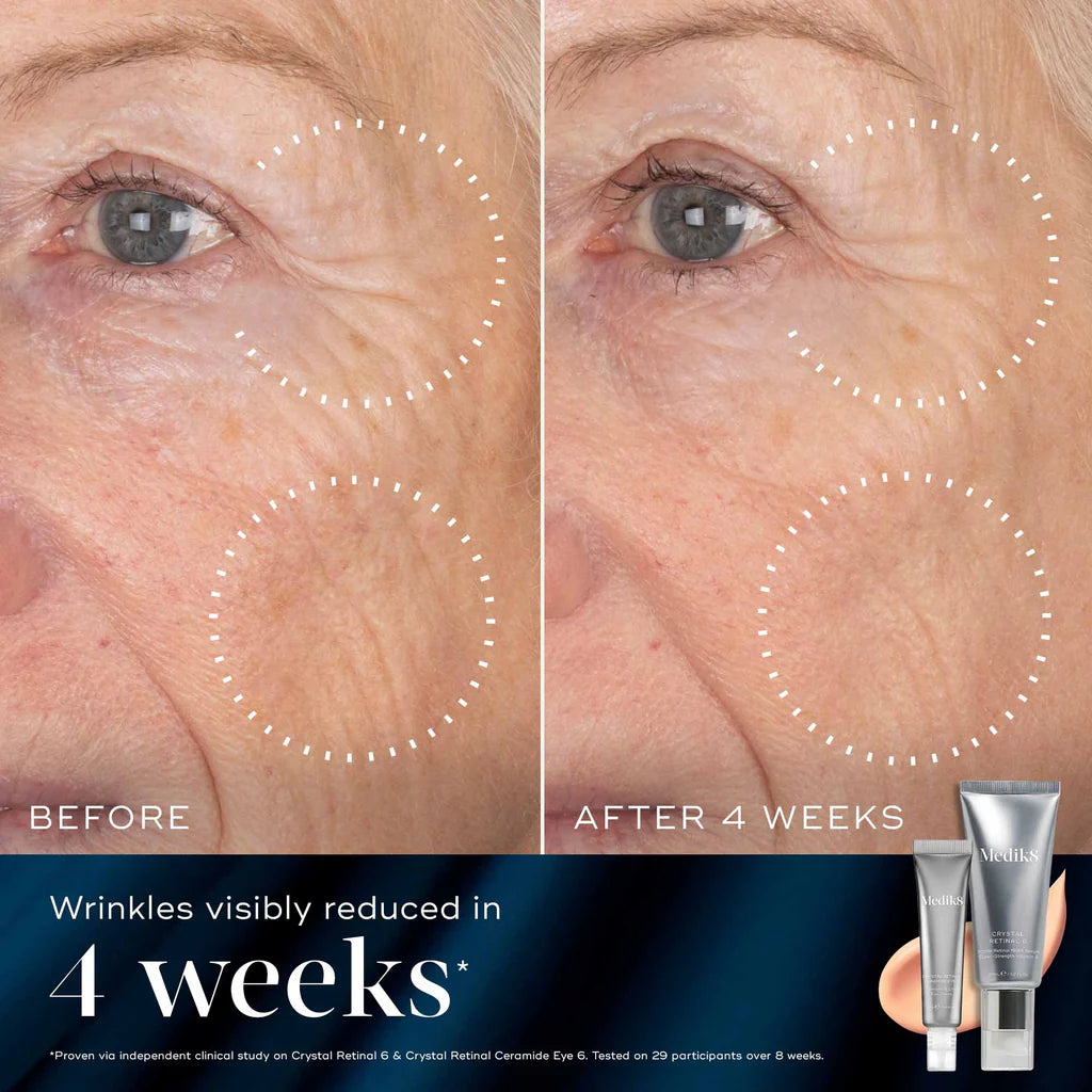 Before and after comparison of facial skin with wrinkles, showing a reduction after 4 weeks, with skincare products displayed.