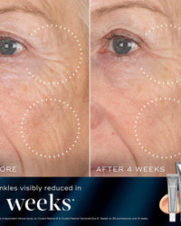 Before and after comparison of facial skin with wrinkles, showing a reduction after 4 weeks, with skincare products displayed.