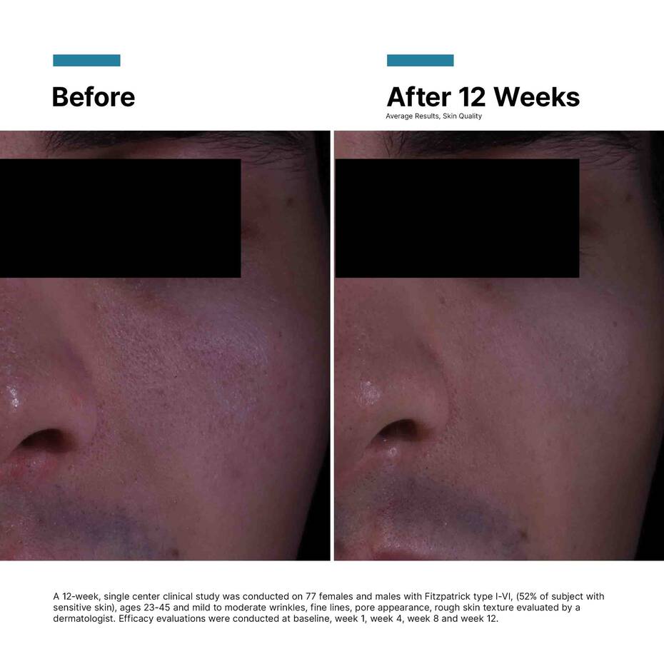 SkinCeuticals P-TIOX Serum 30ml + P-TIOX Cream 48ml Anti-Wrinkle Bundle