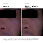 SkinCeuticals P-TIOX Anti-Wrinkle Cream 48ml