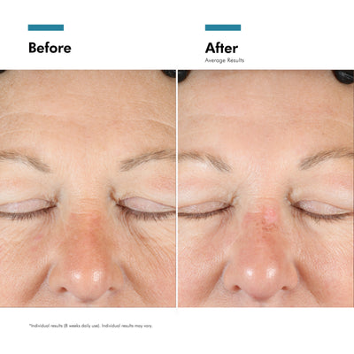 SkinCeuticals A.G.E. Interrupter Advanced Moisturiser 48ml