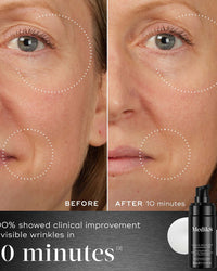 Medik8 Peptide Boosters Kit Liquid Peptides Advanced MP 30ml + Advanced pro-collagen+ Peptide Cream 12.5ml