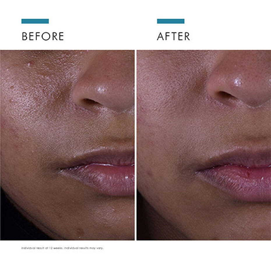 SkinCeuticals Clarify + Protect Bundle