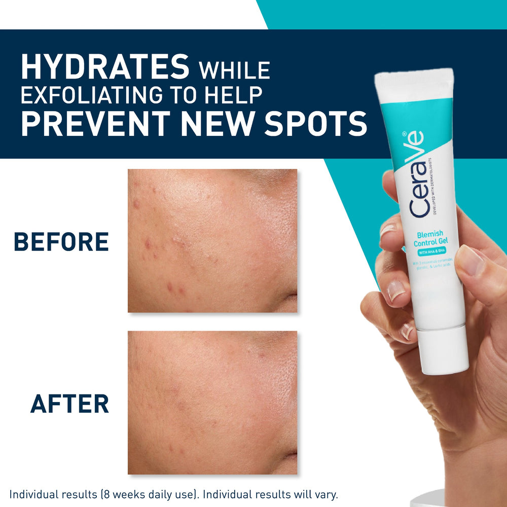 CeraVe Blemish Control Gel 40ml