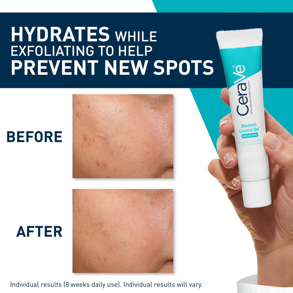 CeraVe Blemish Control Gel 40ml