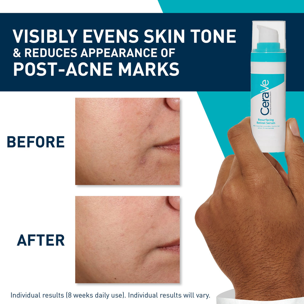 CeraVe Resurfacing Retinol Serum 30ml