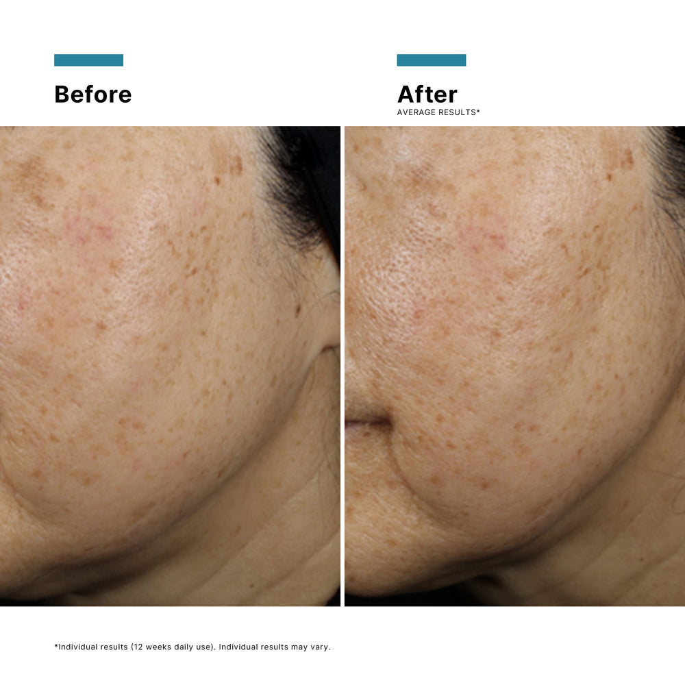{{Product vendor}} {{Product title}}  Serum