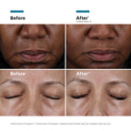 {{Product vendor}} {{Product title}}  Exfoliator, Moisturiser