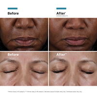 {{Product vendor}} {{Product title}}  Exfoliator, Moisturiser