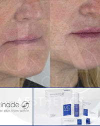 Skinade INsupport