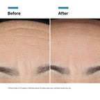 SkinCeuticals Skin Renewal Bundle