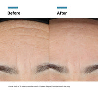 SkinCeuticals Skin Renewal Bundle