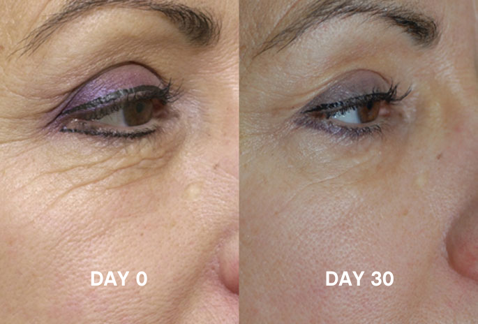 Skinade Collagen Drinks Bottles 30 Days