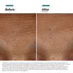 SkinCeuticals HA Intensifier Multi-Glycan before after