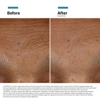 SkinCeuticals HA Intensifier Multi-Glycan before after