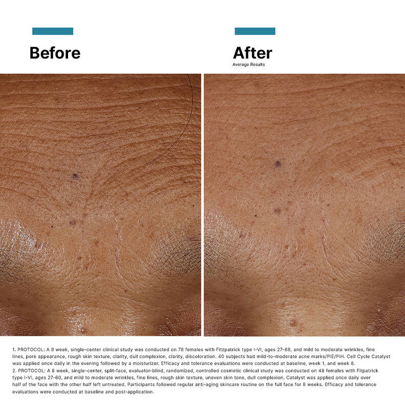 SkinCeuticals HA Intensifier Multi-Glycan before after