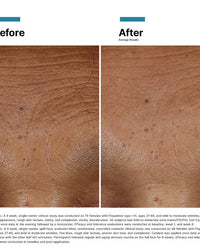 SkinCeuticals HA Intensifier Multi-Glycan before after