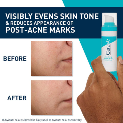 CeraVe Resurfacing Retinol Serum 30ml