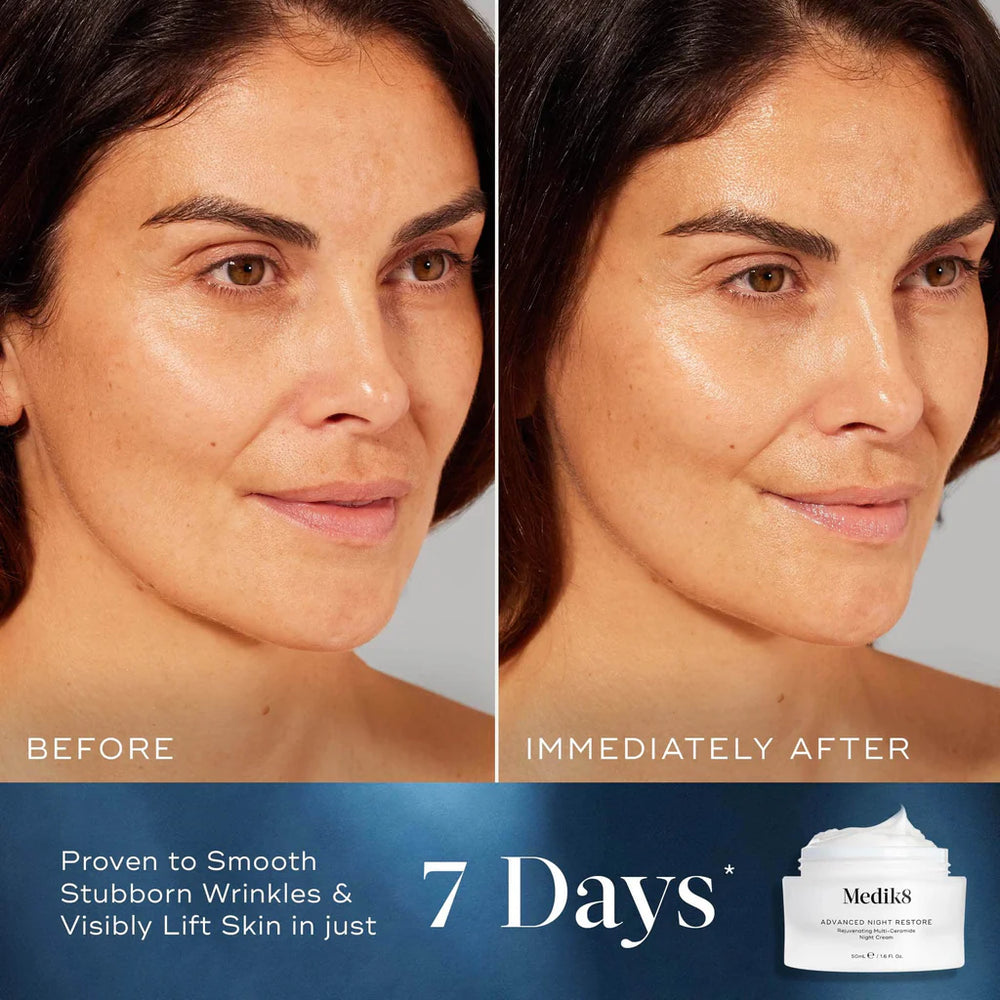 Before and after comparison of a woman's face with Medik8 skincare product shown.