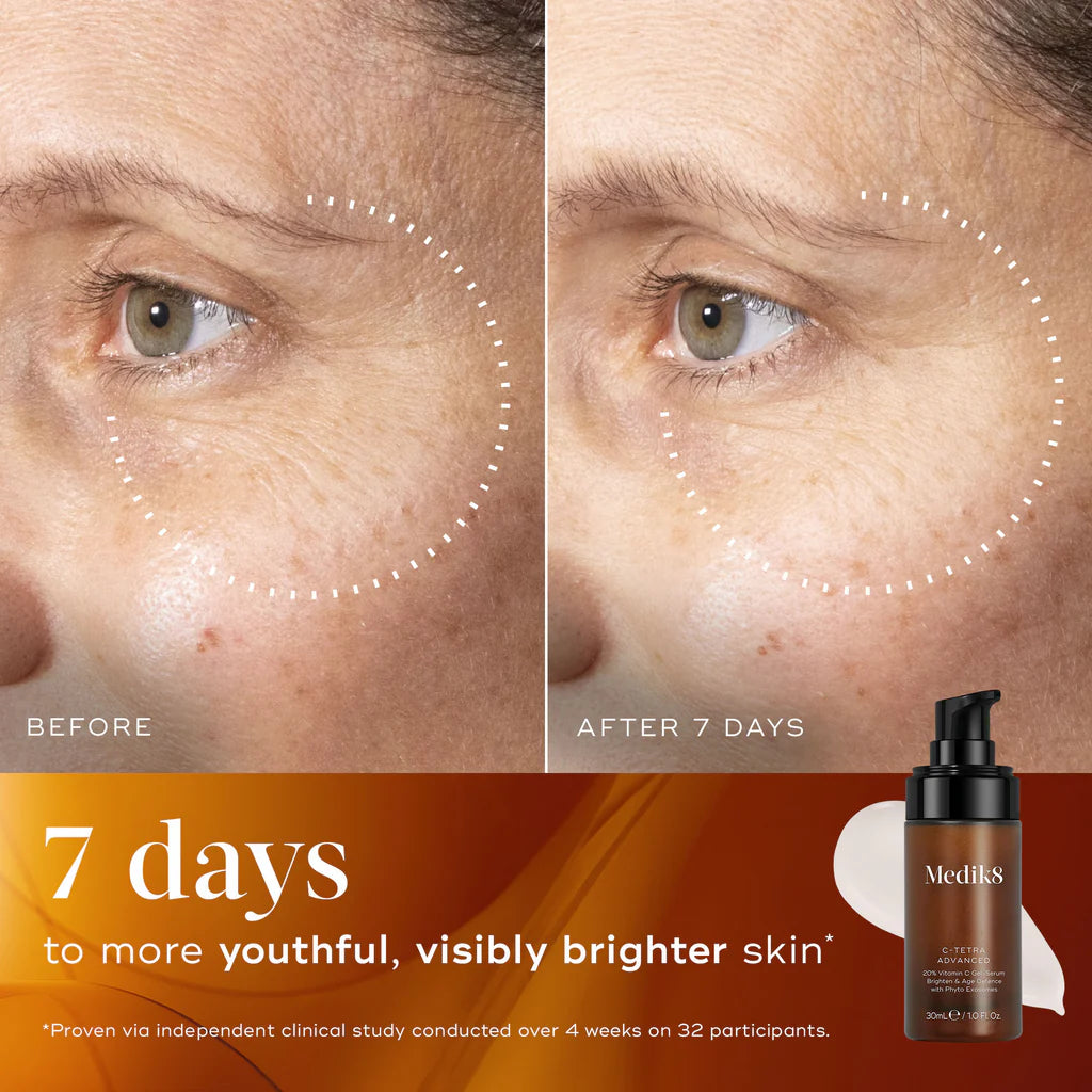 Before and after comparison of skin with visible aging, showing a bottle of Medik8 C-tetra