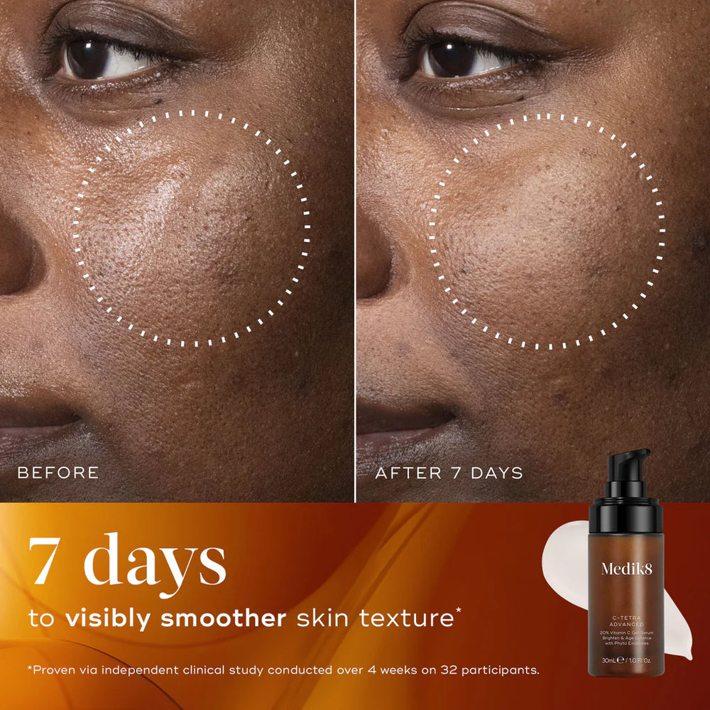 Before and after comparison of skin texture with Medik8 C-Tetra shown