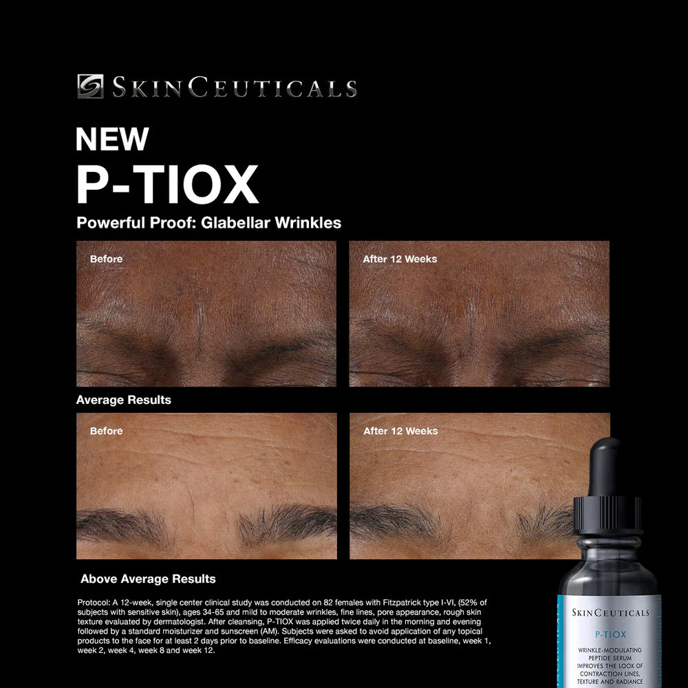 SkinCeuticals P-TIOX 30ml